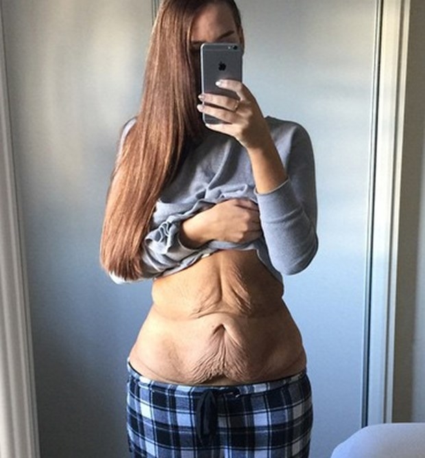 Genç kadının inanılmaz değişimi: 11 ayda 86 kilo verdi 3