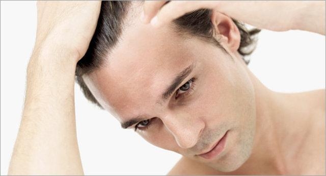 Saç dökülmesinin 20 nedeni 14
