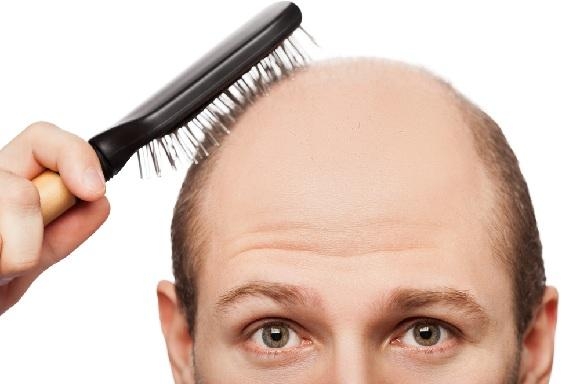 Saç dökülmesinin 20 nedeni 21