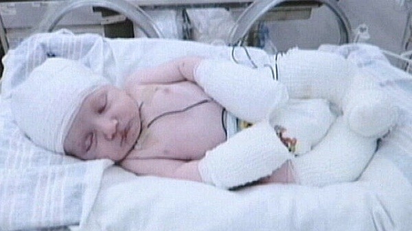 Kansız Doğan Hayalet Bebek Tüm Dünyayı Şaşkına Uğrattı 1