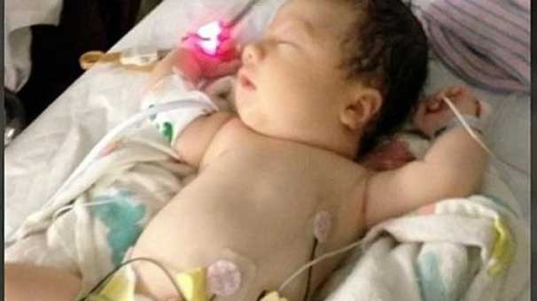 Kansız Doğan Hayalet Bebek Tüm Dünyayı Şaşkına Uğrattı 5
