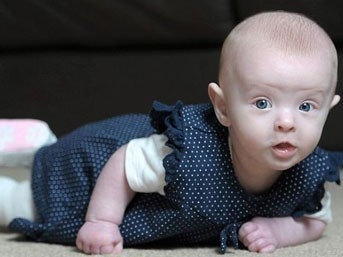 Kansız Doğan Hayalet Bebek Tüm Dünyayı Şaşkına Uğrattı 6