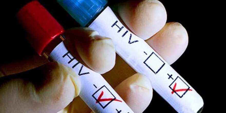 KAN BAĞIŞI YAPMAK İSTERKEN  HIV POZİTİF OLDUĞUNU ÖĞRENDİ