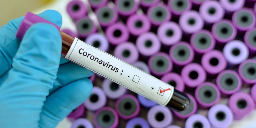 Uzman isimden, "Koronavirüs sıcak havalarda yok olacak" iddiasını çürütecek sözler