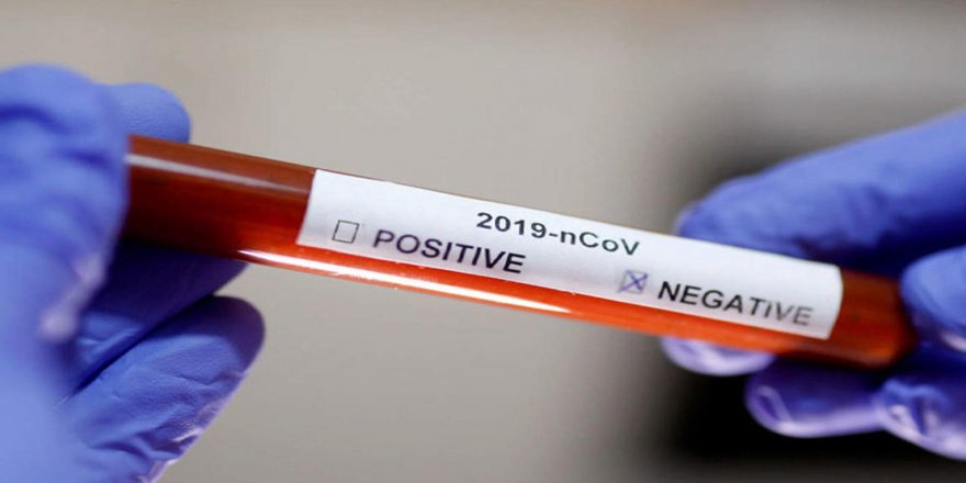KKTC'de 39 gündür pozitif koronavirüs vakası yok.