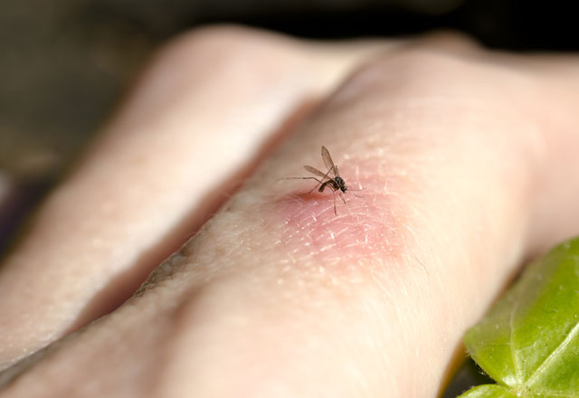 Sivrisinekler en çok kimi ısırır?