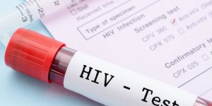3 binden fazla kişiye HIV bulaşmış olabilir!