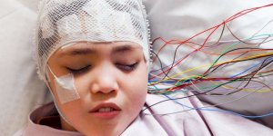 Epilepsi nasıl anlaşılır? Belirtileri ve tedavisi…