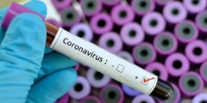 Yeni tip koronavirüsün adı "Covid-19" olarak değiştirildi!