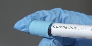İstanbul’da corona virüsü çıkan yolcuyla ilgili flaş açıklama