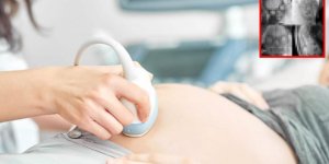Anne karnındaki bebeğin ultrason görüntüsü, ilk kez görenleri ürküttü! Kalbi olan bakmasın