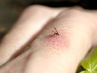 Sivrisinekler en çok kimi ısırır?