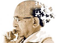 Alzheimer'ın 10 belirtisi ve tedavi yöntemleri